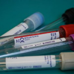 picture of blood sample tubes